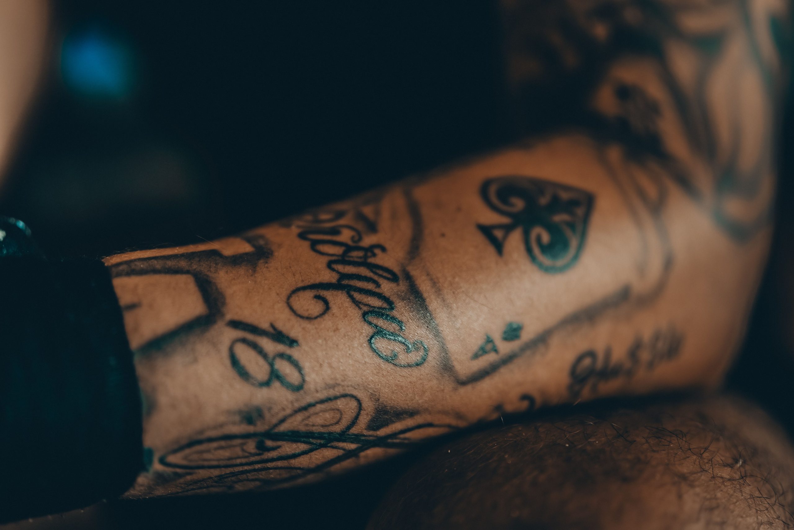 Effacement tatouage blanc peau noire