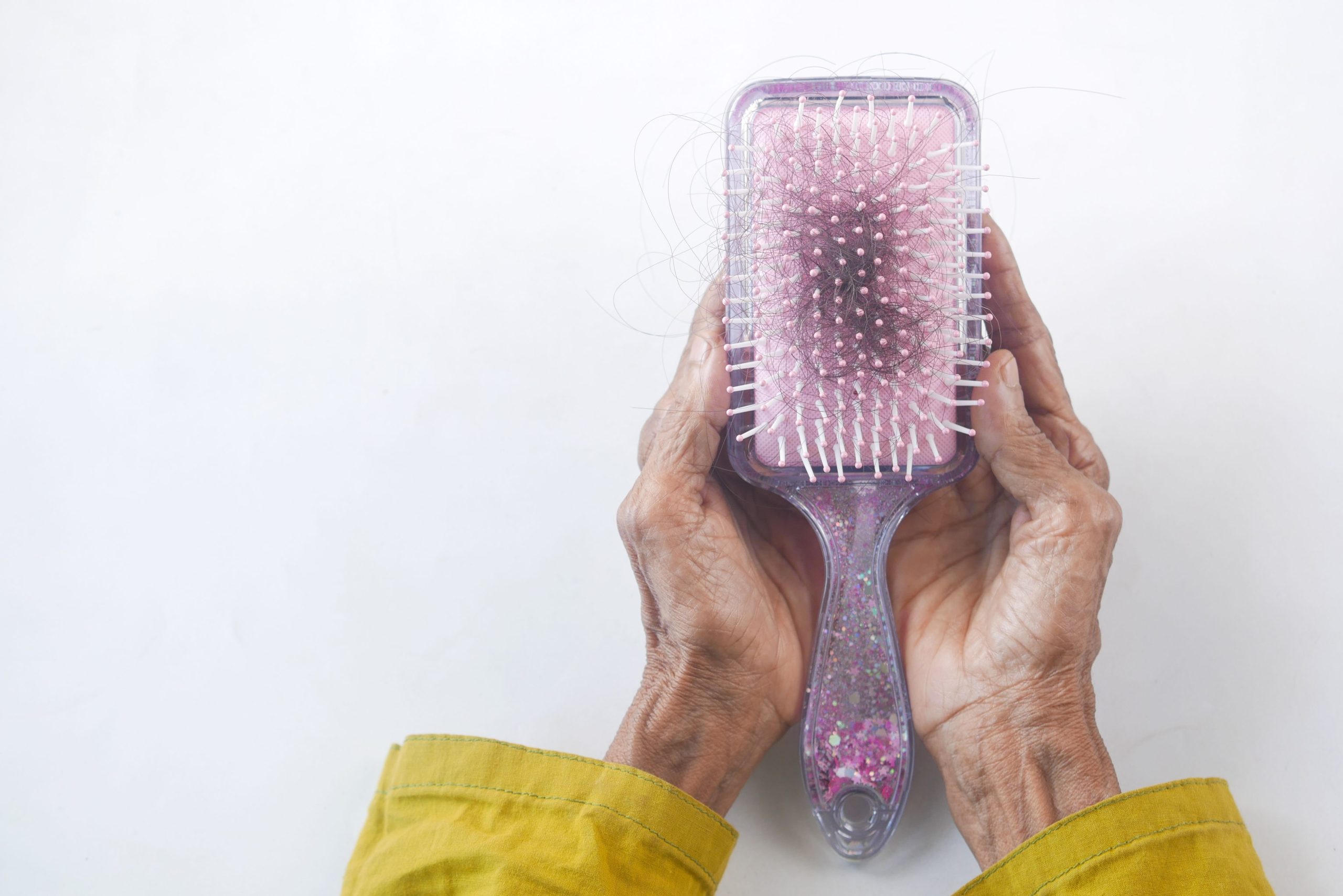 Close-up of senior hands holding a hairbrush with hair strands against a white backdrop. Gros plan des mains d'une personne âgée tenant une brosse à cheveux avec des mèches de cheveux sur un fond blanc.