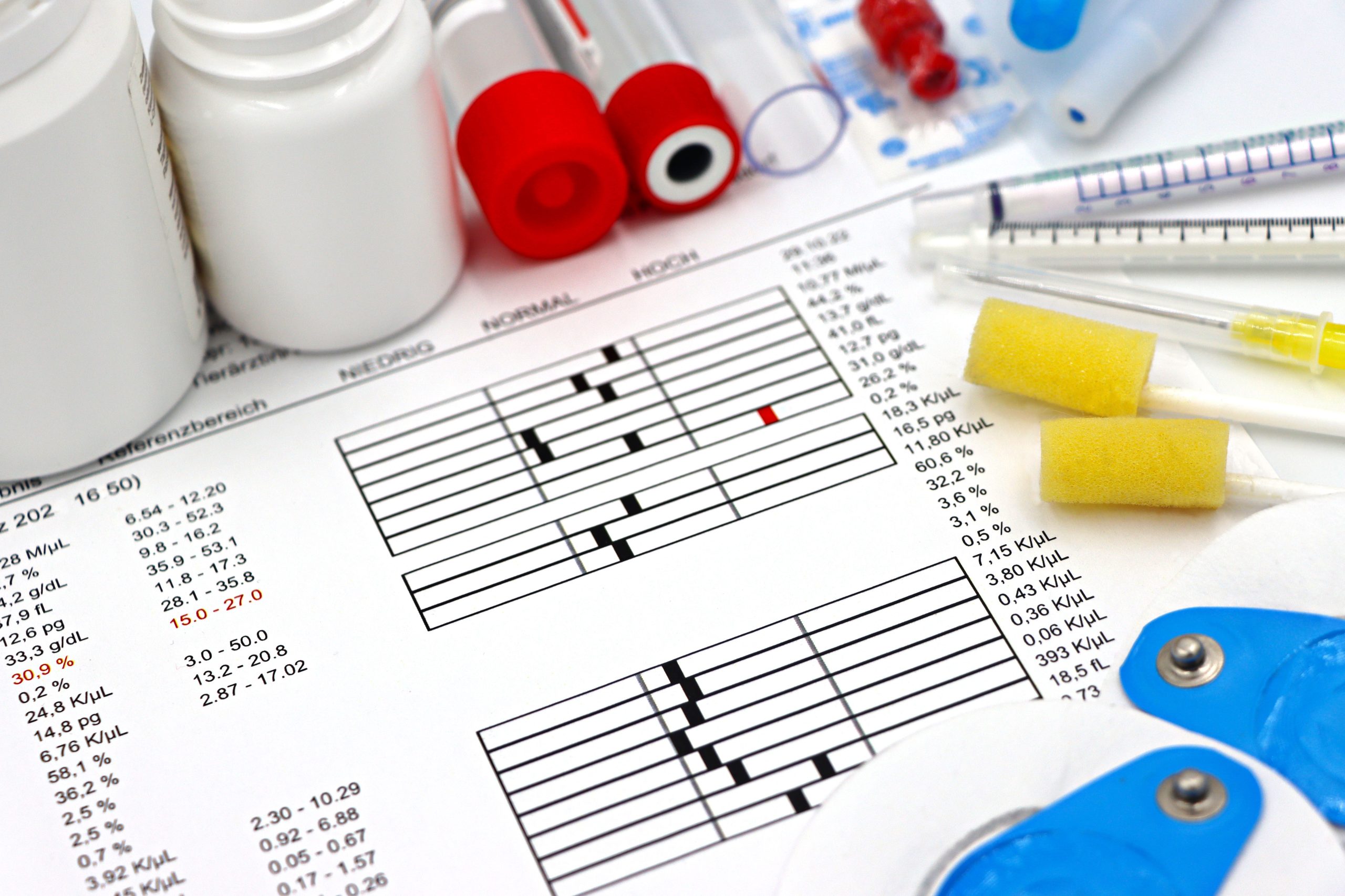 Arrangement of medical equipment, lab tests, and health data on a clinical table. Disposition d'équipements médicaux, de tests de laboratoire et de données de santé sur une table clinique.