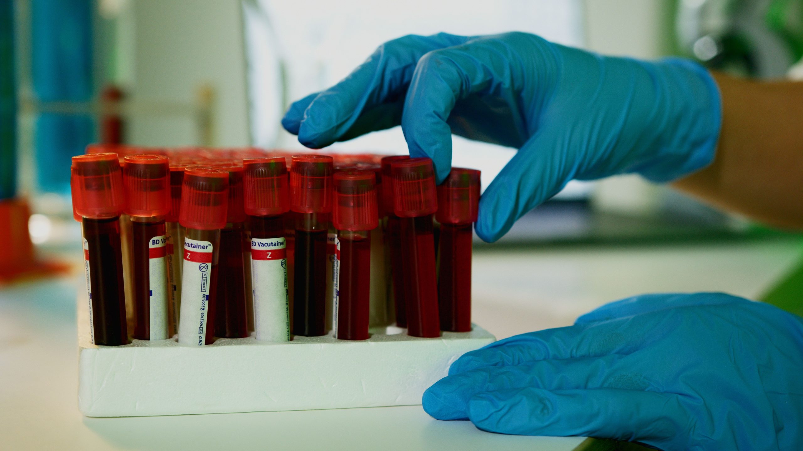 Définition thrombocytopénie