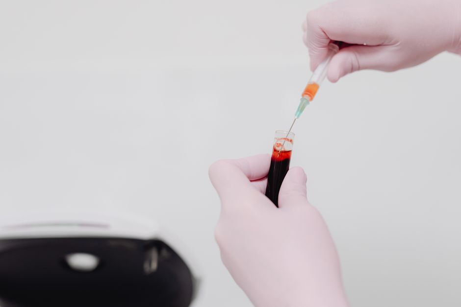 Technicien de laboratoire qui manipule un prélèvement sanguin