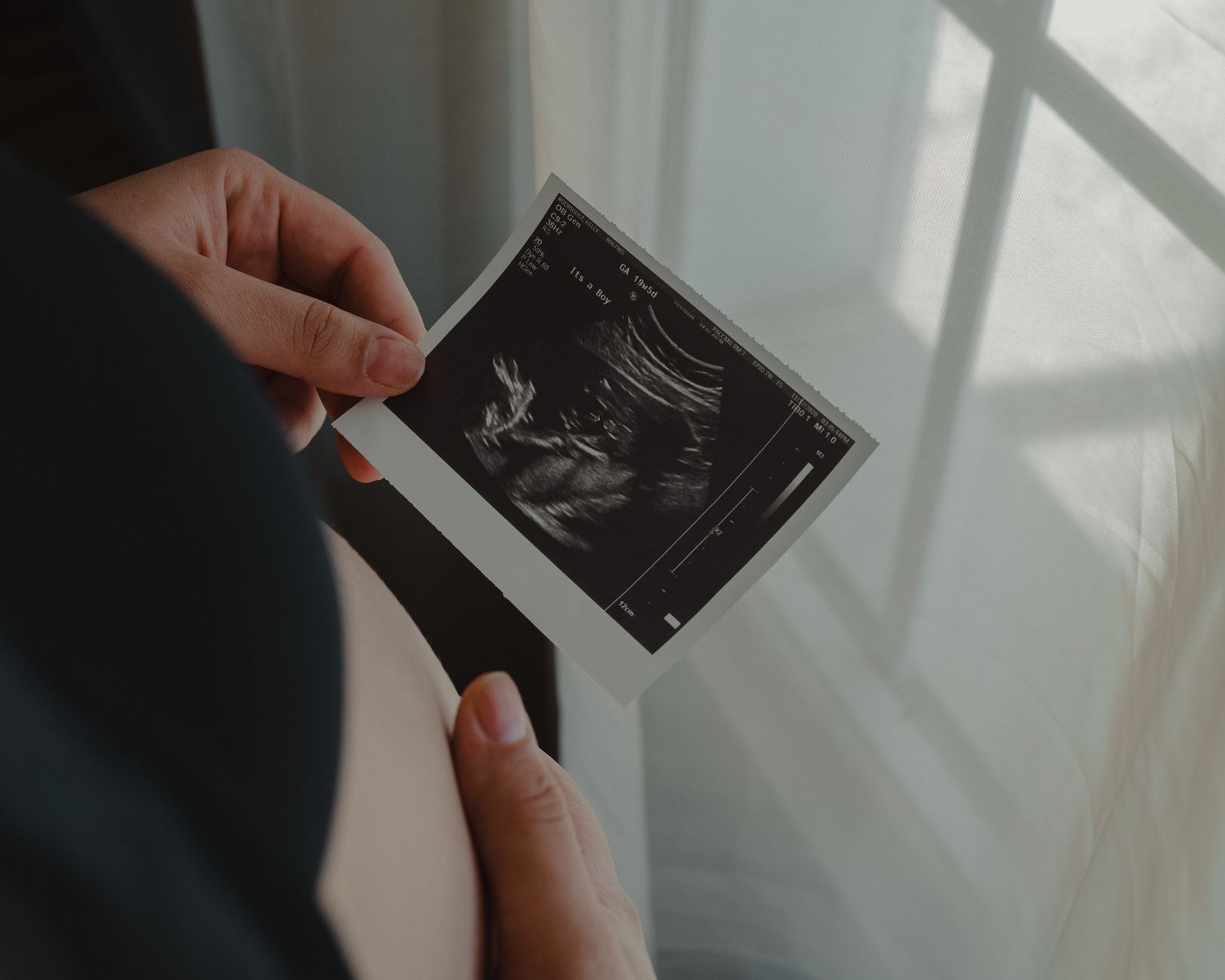 Femme enceinte tenant une photo d'échographie